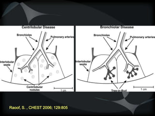 Raoof, S. , CHEST 2006; 129:805
 