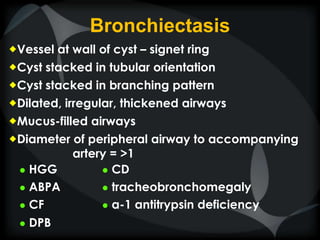 Bronchiectasis
Vessel at wall of cyst – signet ring
Cyst stacked in tubular orientation
Cyst stacked in branching pattern
Dilated, irregular, thickened airways
Mucus-filled airways
Diameter of peripheral airway to accompanying
artery = >1
● HGG ● CD
● ABPA ● tracheobronchomegaly
● CF ● α-1 antitrypsin deficiency
● DPB
 