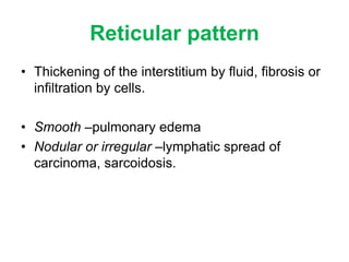 What Is A Reticular Pattern HRCT LUNG-BASIC INTERPRETATION | PPT