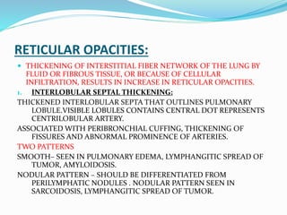 Hrct of idiopathic interstitial pneumonias | PPTX