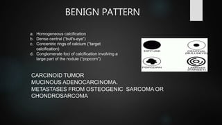 HRCT evaluation of nodular lung diseases and CT guided biopsy of ...