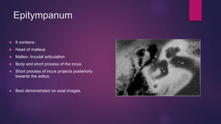 Incus Project High Resolution Computer TomographyTEMPORAL BONE Pathology.pptx