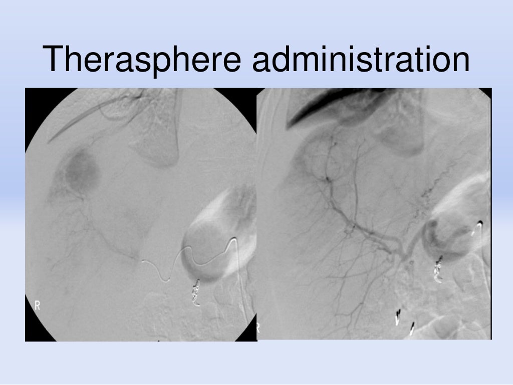 Primer on interventional radiology procedures