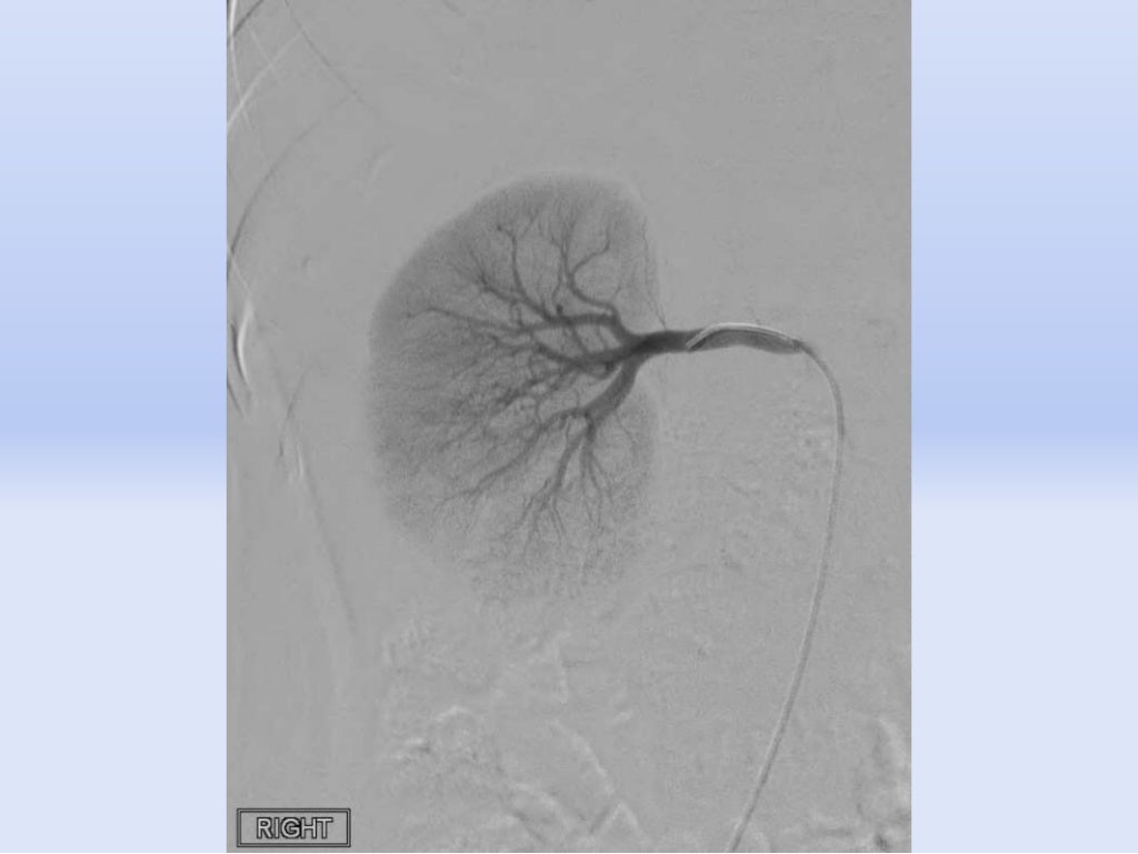Primer on interventional radiology procedures