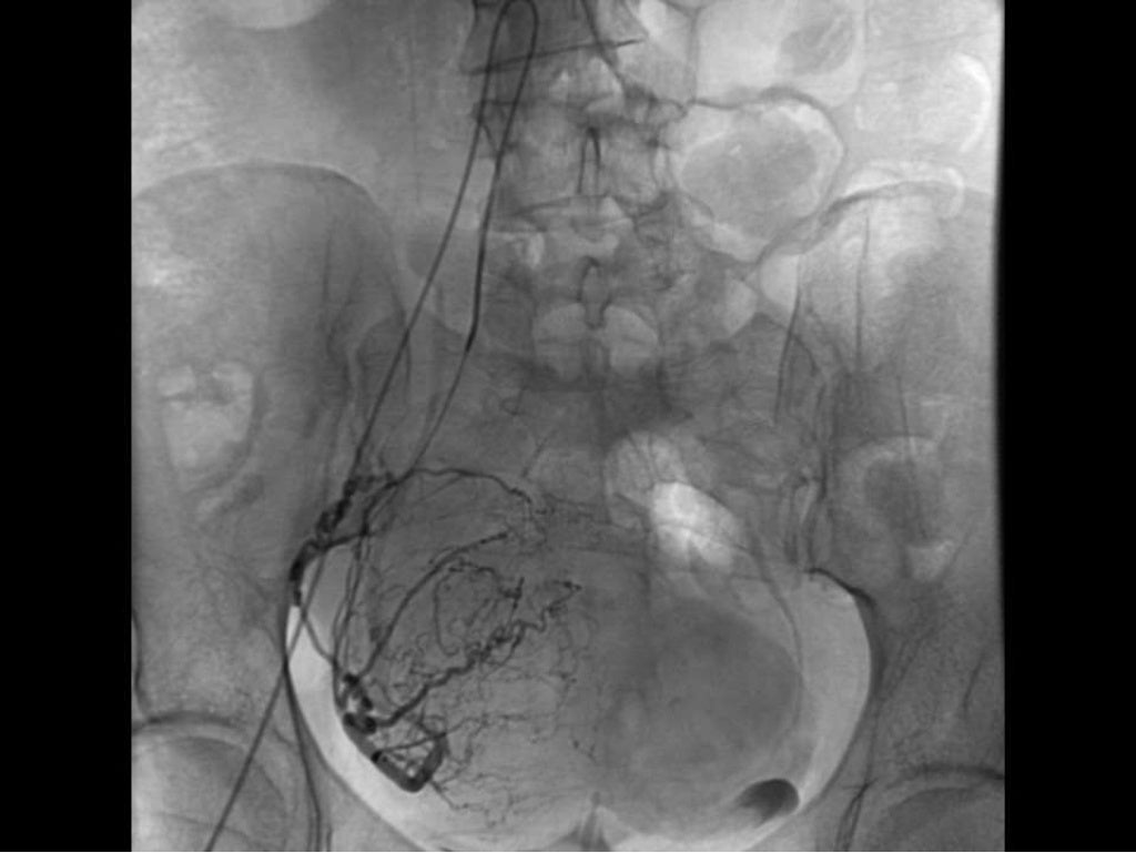 Primer on interventional radiology procedures