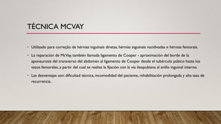 Mcvay Incision Hérnia Crural.pdf