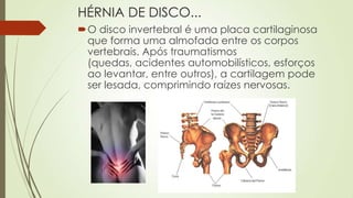 HÉRNIA DE DISCO...
O disco invertebral é uma placa cartilaginosa
que forma uma almofada entre os corpos
vertebrais. Após traumatismos
(quedas, acidentes automobilísticos, esforços
ao levantar, entre outros), a cartilagem pode
ser lesada, comprimindo raízes nervosas.
 