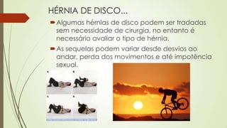 HÉRNIA DE DISCO...
Algumas hérnias de disco podem ser tradadas
sem necessidade de cirurgia, no entanto é
necessário avaliar o tipo de hérnia.
As sequelas podem variar desde desvios ao
andar, perda dos movimentos e até impotência
sexual.
 