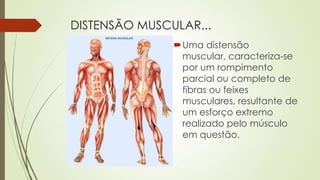 DISTENSÃO MUSCULAR...
Uma distensão
muscular, caracteriza-se
por um rompimento
parcial ou completo de
fibras ou feixes
musculares, resultante de
um esforço extremo
realizado pelo músculo
em questão.
 