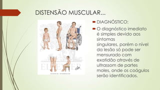 DISTENSÃO MUSCULAR...
DIAGNÓSTICO:
O diagnóstico imediato
é simples devido aos
sintomas
singulares, porém o nível
da lesão só pode ser
mensurado com
exatidão através de
ultrassom de partes
moles, onde os coágulos
serão identificados.
 