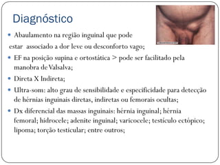 Diagnóstico
 Abaulamento na região inguinal que pode
estar associado a dor leve ou desconforto vago;
 EF na posição supina e ortostática > pode ser facilitado pela
  manobra de Valsalva;
 Direta X Indireta;
 Ultra-som: alto grau de sensibilidade e especificidade para detecção
  de hérnias inguinais diretas, indiretas ou femorais ocultas;
 Dx diferencial das massas inguinais: hérnia inguinal; hérnia
  femoral; hidrocele; adenite inguinal; varicocele; testículo ectópico;
  lipoma; torção testicular; entre outros;
 