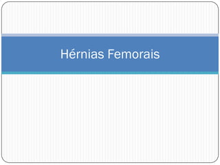 Hérnias Femorais
 