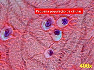 400x
Pequena população de células
 