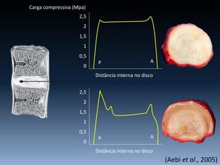 (Aebi et al., 2005)
P A
Distância interna no disco
2,5
2
1,5
1
0,5
0
P A
Distância interna no disco
2,5
2
1,5
1
0,5
0
Carga compressiva (Mpa)
 