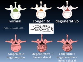 (White e Panjabi, 1990)
 