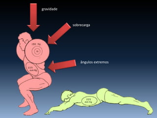 gravidade
sobrecarga
ângulos extremos
 