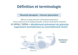Définition et terminologie
HRP est un type particulier d’hématome placentaire:
Entre le placenta et les caduques basales (à partir du deuxième trimestre)
DPPNI / DPPAI = décollement prématuré du placenta
auparavant normalement ou anormalement inséré
Décollement
marginal
Décollement
marginal
Placental abruption = fracture placentaire
Placental abruption = fracture placentaire
 