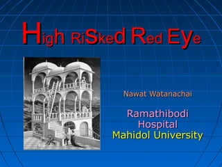 High Risked Red Eye
Nawat Watanachai

Ramathibodi
Hospital
Mahidol University

 