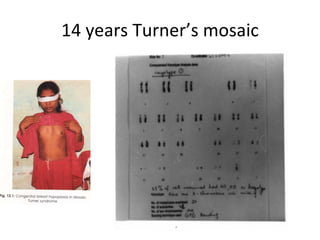 14 years Turner’s mosaic 