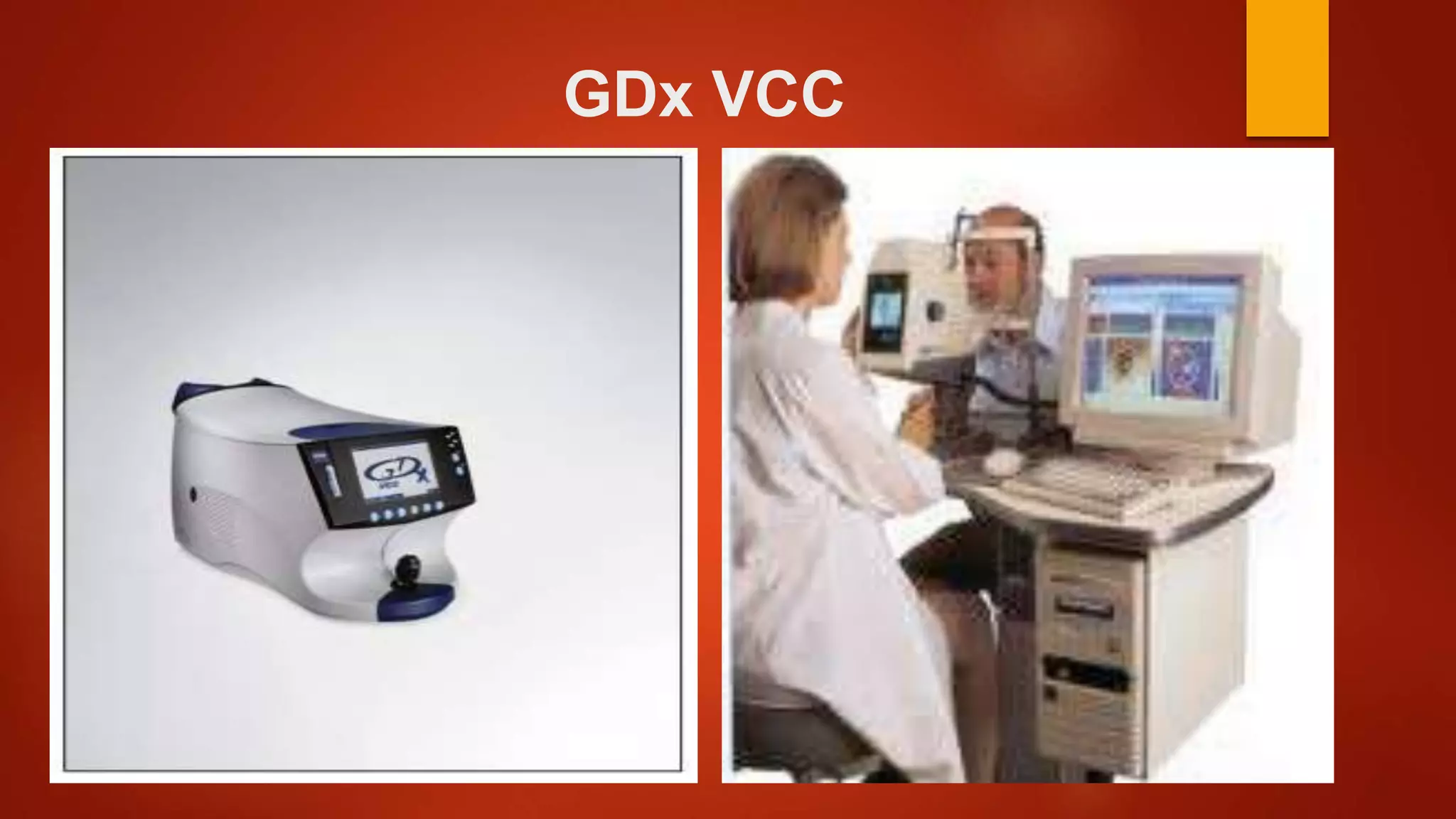 GDx VCC
 