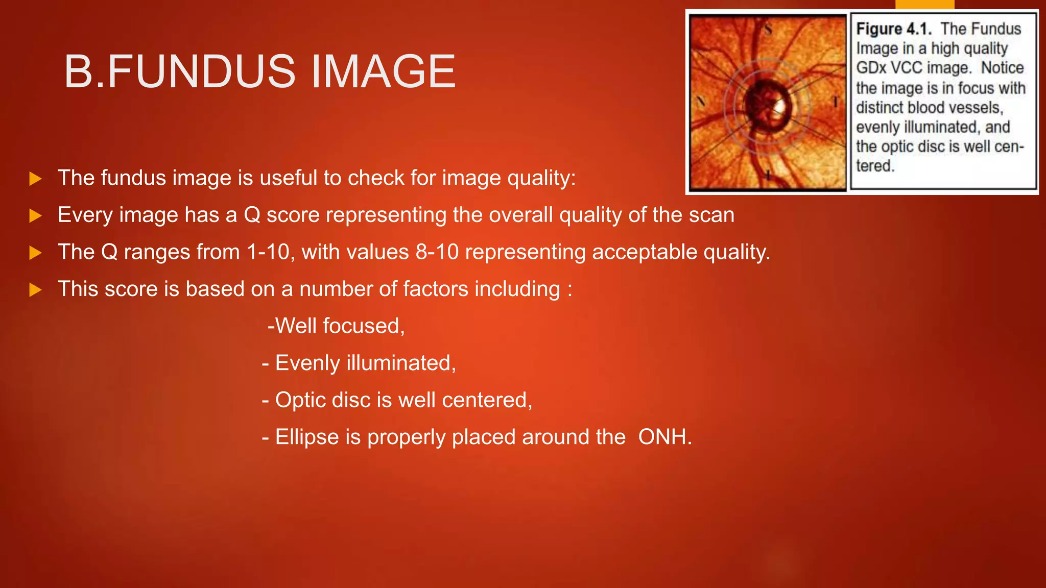 B.FUNDUS IMAGE
 The fundus image is useful to check for image quality:
 Every image has a Q score representing the overall quality of the scan
 The Q ranges from 1-10, with values 8-10 representing acceptable quality.
 This score is based on a number of factors including :
-Well focused,
- Evenly illuminated,
- Optic disc is well centered,
- Ellipse is properly placed around the ONH.
 