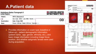 A.Patient data
 Provides information on exam type (baseline or
follow-up), patient demographic information
(patient name , age, gender, ethnicity, etc.), and
basic image information including image focus
position, and whether astigmatic lenses were used
during acquisition.
 