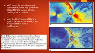  VCC stands for variable corneal
compensator, which was created to
account for the variable corneal
birefringence in patients
 Uses the birefringence of Henle’s
layer in the macula as a control for
measurement of corneal
birefringence
 