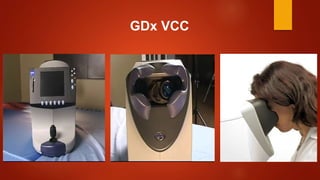 GDx VCC
 