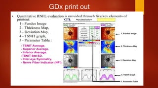 GDx print out
 