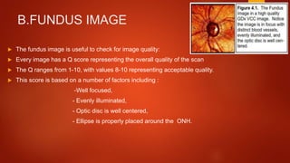 B.FUNDUS IMAGE
 The fundus image is useful to check for image quality:
 Every image has a Q score representing the overall quality of the scan
 The Q ranges from 1-10, with values 8-10 representing acceptable quality.
 This score is based on a number of factors including :
-Well focused,
- Evenly illuminated,
- Optic disc is well centered,
- Ellipse is properly placed around the ONH.
 