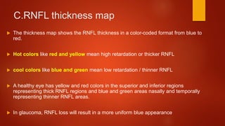 C.RNFL thickness map
 The thickness map shows the RNFL thickness in a color-coded format from blue to
red.
 Hot colors like red and yellow mean high retardation or thicker RNFL
 cool colors like blue and green mean low retardation / thinner RNFL
 A healthy eye has yellow and red colors in the superior and inferior regions
representing thick RNFL regions and blue and green areas nasally and temporally
representing thinner RNFL areas.
 In glaucoma, RNFL loss will result in a more uniform blue appearance
 