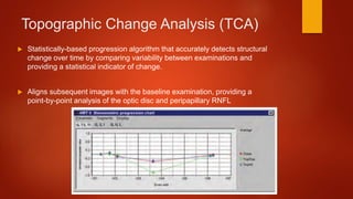 Topographic Change Analysis (TCA)
 Statistically-based progression algorithm that accurately detects structural
change over time by comparing variability between examinations and
providing a statistical indicator of change.
 Aligns subsequent images with the baseline examination, providing a
point-by-point analysis of the optic disc and peripapillary RNFL
 