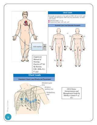 (Lippincott
                    Manual of
                    Nursing
                    Practice, 8th Ed.
                    By Nettina,
                    S.M., Mills, E.J.,
                    P. 333)




                                             (ECG Notes:
                                          Interpretation and
                                         Management Guide by
                                         Shirley A. Jones P. 13,
                                                  16.)
HS 194 | 1/7/2010




   9
 