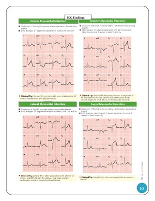 ECG Findings




     HS 194 | 1/7/2010




10
 