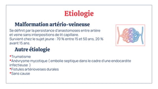 Etiologie
Malformation artério-veineuse
Se définit par la persistance d’anastomoses entre artère
et veine sans interpositions de lit capillaire.
Survient chez le sujet jeune : 70 % entre 15 et 50 ans, 20 %
avant 15 ans.
Autre étiologie
•Trumatisme
•Anévrysme mycotique ( embolie septique dans le cadre d’une endocardite
infectieuse )
•Fistules artérioveises durales
•Sans cause
 