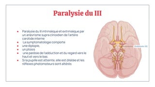 Paralysie du III
● Paralysie du III intrinsèque et extrinsèque par
un anévrisme supra clinoidien de l'artère
carotide interne
● La symptomatologie comporte
● une diplopie,
● un ptosis
● une parésie de l'adduction et du regard vers le
haut et vers le bas.
● Si la pupille est atteinte, elle est dilatée et les
réflexes photomoteurs sont altérés
 