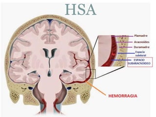HSA
 