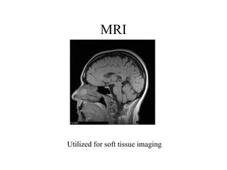 MRI Utilized for soft tissue imaging 