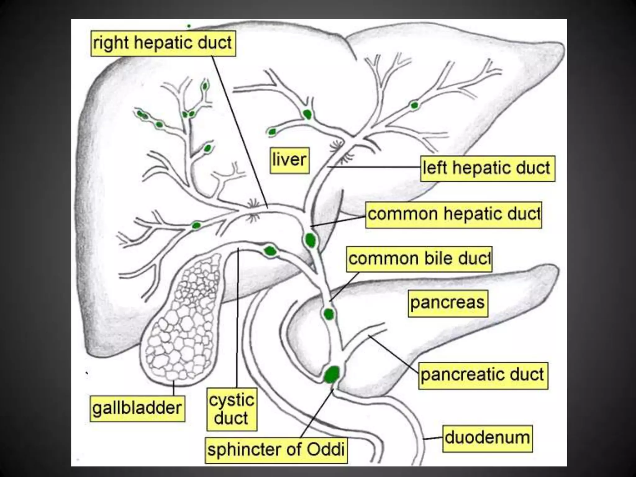 Hemolytic AnemiaNot enough red blood cells in the bloodTypes -> reason for destruction of RBCCould be w/in RBC itself (Intrinsic factors) or outside the RBC (Extrinsic factors)Intrinsic FactorsDefects in hemoglobin productionSickle-cell diseaseDefects of red blood cell membrane productionHereditary spherocytosis