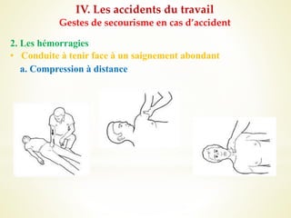 IV. Les accidents du travail
Gestes de secourisme en cas d’accident
2. Les hémorragies
• Conduite à tenir face à un saignement abondant
a. Compression à distance
 