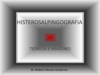 HISTEROSALPINGOGRAFIA
TECNICAS E IMAGENES
Dr. Robert Alonso Gutiérrez
 
