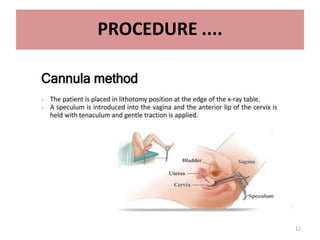 12
PROCEDURE ....
• Tenaculm is used to hold anterior lip of cervix .
• Speculum is removed & Patient is placed in slight
trendelenburg position and contrast is slowly given
• 3 ml contrast to fill uterine cavity and another 3 ml to
fill tube. ( up to 10 ml)
• 4 spot films are taken
• Additional oblique views may be taken for optimal
visualisation of pelvic pathology and tortuous fallopian
tubes( to see retroverted or anteverted)
• After end of the procedure , antibiotic course is given
and patient is informed about vaginal spotting for 1-2
days
 