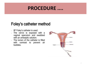 15
PROCEDURE ....
• Tenaculm is used to hold anterior lip of cervix .
• Speculum is removed & Patient is placed in slight
trendelenburg position and contrast is slowly given
• 3 ml contrast to fill uterine cavity and another 3 ml to
fill tube. ( up to 10 ml)
• 4 spot films are taken
• Additional oblique views may be taken for optimal
visualisation of pelvic pathology and tortuous fallopian
tubes( to see retroverted or anteverted)
• After end of the procedure , antibiotic course is given
and patient is informed about vaginal spotting for 1-2
days
 