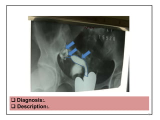  Diagnosis:.
 Description:.
40
 