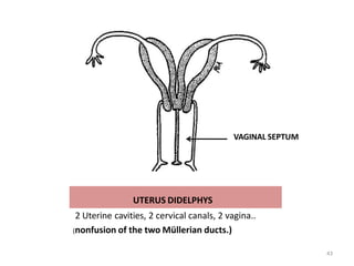 UTERUS DIDELPHYS
2 Uterine cavities, 2 cervical canals, 2 vagina..
(nonfusion of the two Müllerian ducts.)
VAGINAL SEPTUM
43
 
