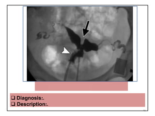 BICORNUATEBICOLLIS
46
 Diagnosis:.
 Description:.
 