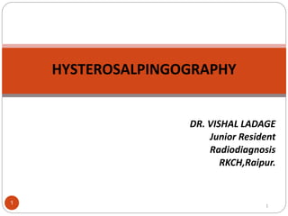HYSTEROSALPINGOGRAPHY
DR. VISHAL LADAGE
Junior Resident
Radiodiagnosis
RKCH,Raipur.
1 1
 
