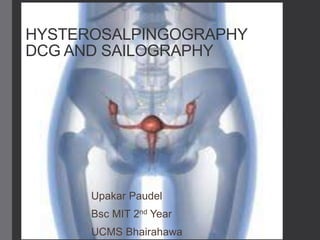 HYSTEROSALPINGOGRAPHY
DCG AND SAILOGRAPHY
Upakar Paudel
Bsc MIT 2nd Year
UCMS Bhairahawa
 