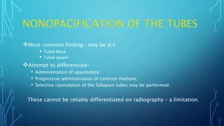 Most common finding- may be d/t
 Tubal block
 Tubal spasm
Attempt to differentiate-
• Administration of spasmolytic.
• Progressive administration of contrast medium.
• Selective cannulation of the fallopian tubes may be performed.
These cannot be reliably differentiated on radiography – a limitation.
 