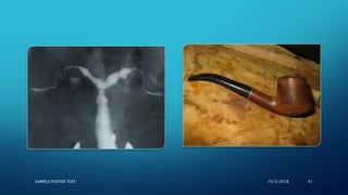 SAMPLE FOOTER TEXT 10/3/2018 41
 